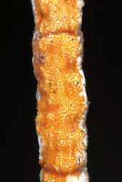 Epichloë typhina