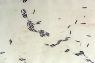 Sirococcus conigenus