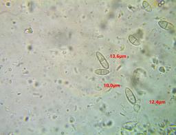 Thyronectria sinopica
