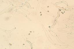 Tubaria furfuracea