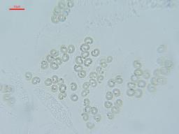 Eutypa crustata