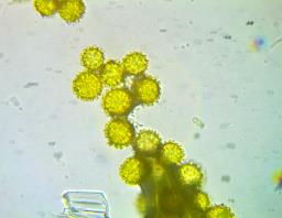 Hypomyces microspermus