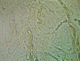 Lasiosphaeria ovina