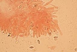 Pseudotricholoma metapodium
