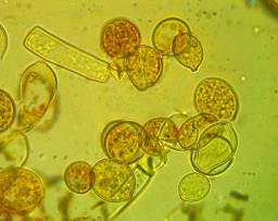 Botryobasidium simile