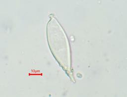 Hohenbuehelia petaloides