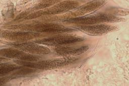 Diatrypella favacea