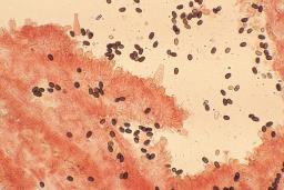Psathyrella marquana