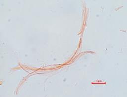 Cordyceps militaris