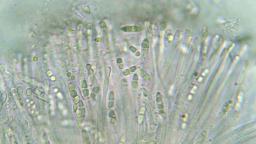Coenogonium pineti