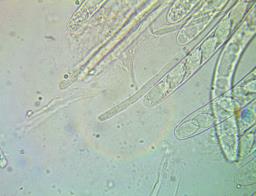 Ciboria coryli