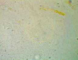 Calycina vulgaris