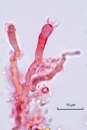 Gloeocystidiellum clavuligerum