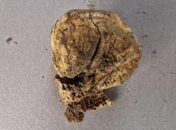 Scleroderma bovista