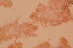Calyptella capula