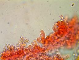 Trechispora mollusca