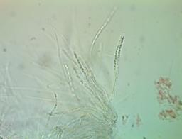 Phomatospora berkeleyi