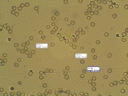 Lycoperdon lividum