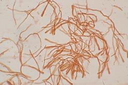 Dacrymyces capitatus