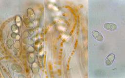 Octospora humosa