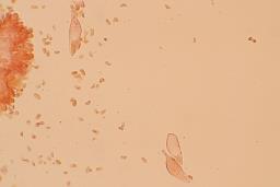 Mycena leptocephala