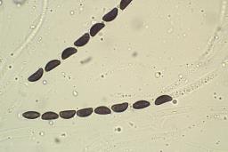 Jackrogersella multiformis
