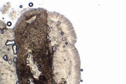 Tapesia lividofusca