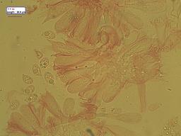 Linopodium filopes
