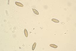 Xerocomellus pruinatus