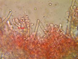 Amphinema byssoides