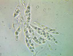 Natantiella ligneola