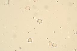 Hydnum melitosarx