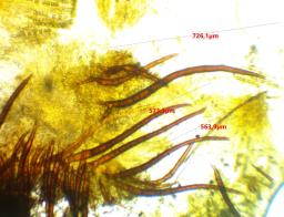 Scutellinia trechispora