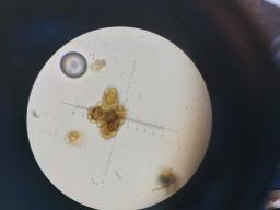 Urocystis colchici