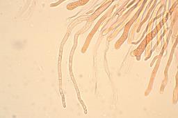 Calocera glossoides