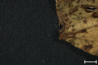 Uromyces appendiculatus