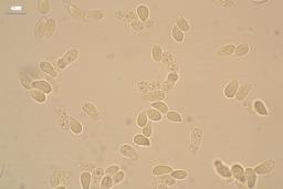 Arrhenia