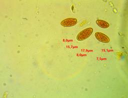 Ciboria coryli