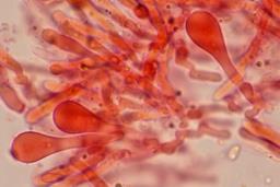 Phlebia rufa