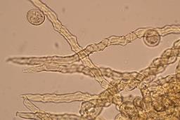 Trichia varia