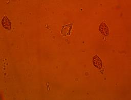 Calonarius suaveolens
