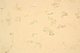 Arrhenia
