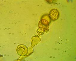 Botryobasidium simile