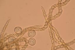 Trichia varia
