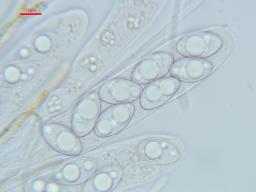 Octospora leucoloma