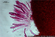 Neonectria neomacrospora