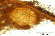 Sphaerulina quercicola