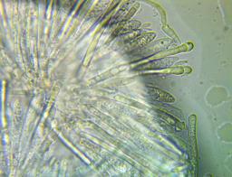 Tapesia lividofusca